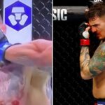 Tom Aspinall hospitalised after eye injury halts UFC 321 title defence