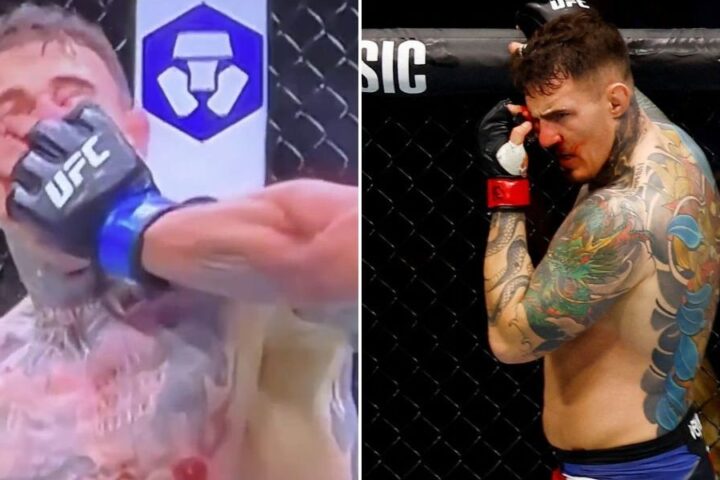 Tom Aspinall hospitalised after eye injury halts UFC 321 title defence