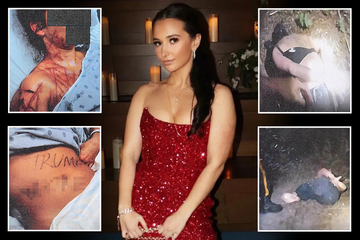 Ex-Republican staffer accused of staging assault with political slurs on her body