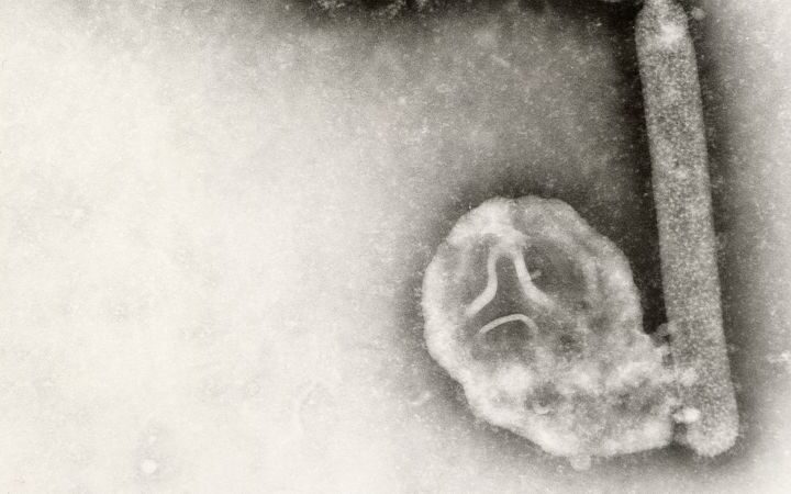 First human case of bird flu in the US this year linked to new virus strain