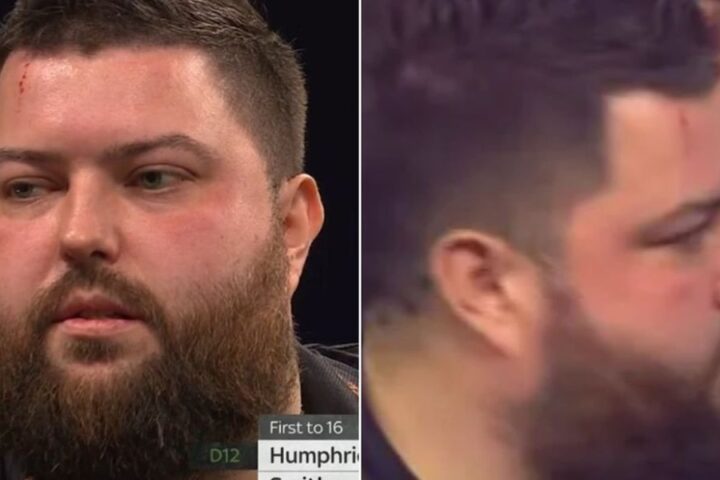 Michael Smith injures forehead during Grand Slam of Darts match against Luke Humphries
