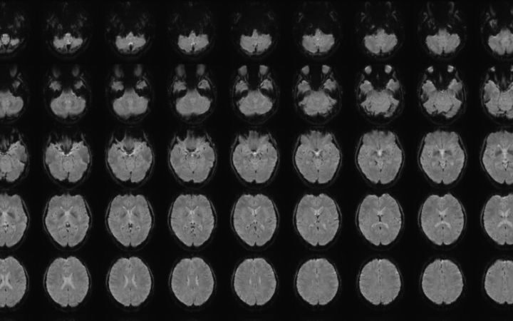 Scientist develops mind-captioning technology to translate mental images into text