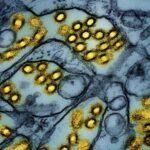 Washington resident dies from human infection of novel bird flu strain