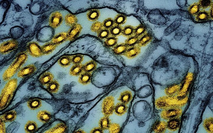 Washington resident dies from human infection of novel bird flu strain