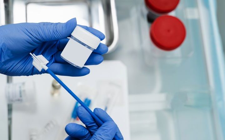 Cervical cancer screening guidelines updated to allow self-collection of samples