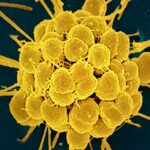 FDA approves first new antibiotics for gonorrhea in decades amid rising drug resistance