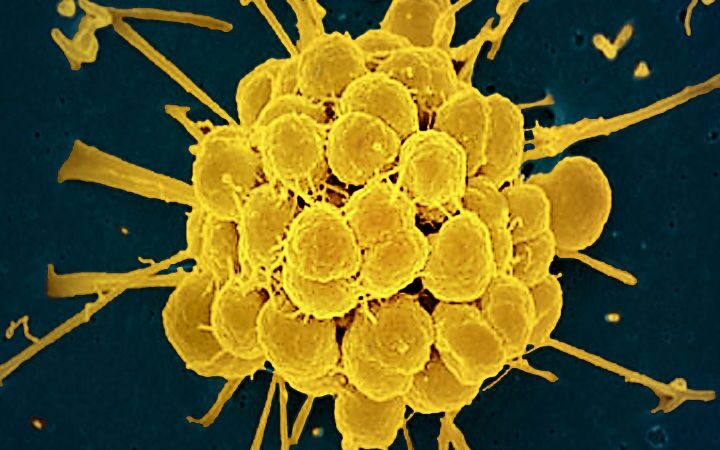 FDA approves first new antibiotics for gonorrhea in decades amid rising drug resistance