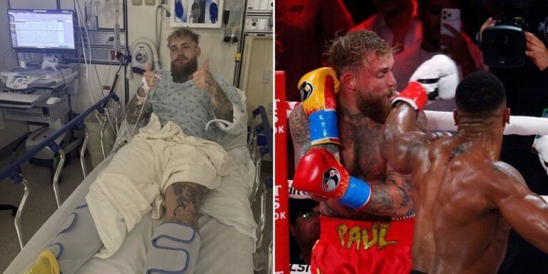 Jake Paul shares recovery update after surgery for severe jaw injury ...