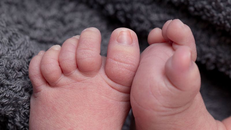 US stillbirth rate decreases by 2% in 2024, driven by improvements in several states