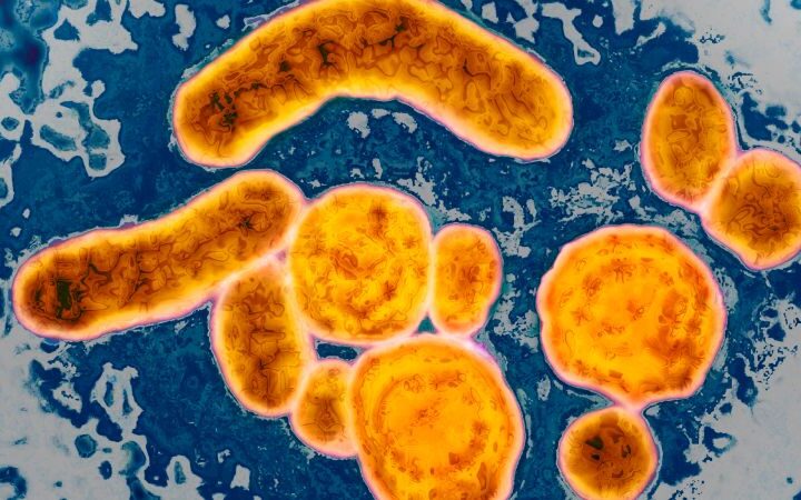 US vaccine advisers debate potential removal of universal hepatitis B vaccine recommendation for infants