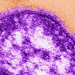 Measles outbreak in South Carolina linked to declining vaccination rates and community hesitancy