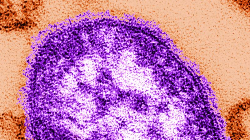 Measles outbreak in South Carolina linked to declining vaccination rates and community hesitancy