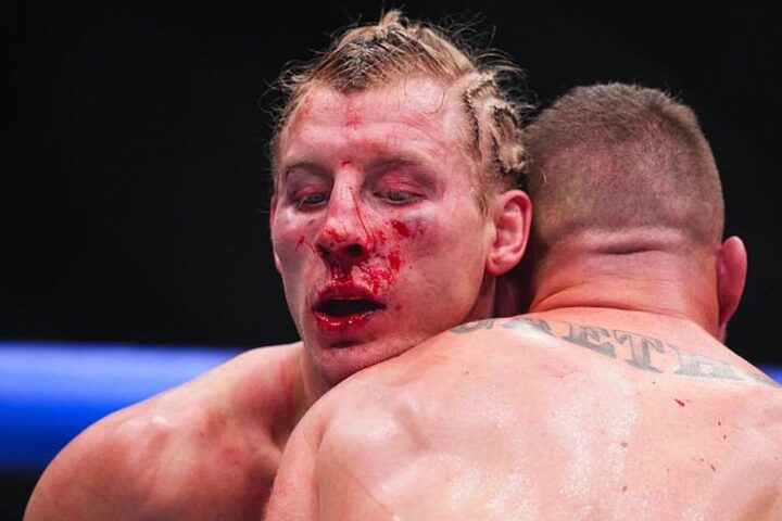 Paddy Pimblett hospitalized after loss to Justin Gaethje at UFC 324 in Las Vegas