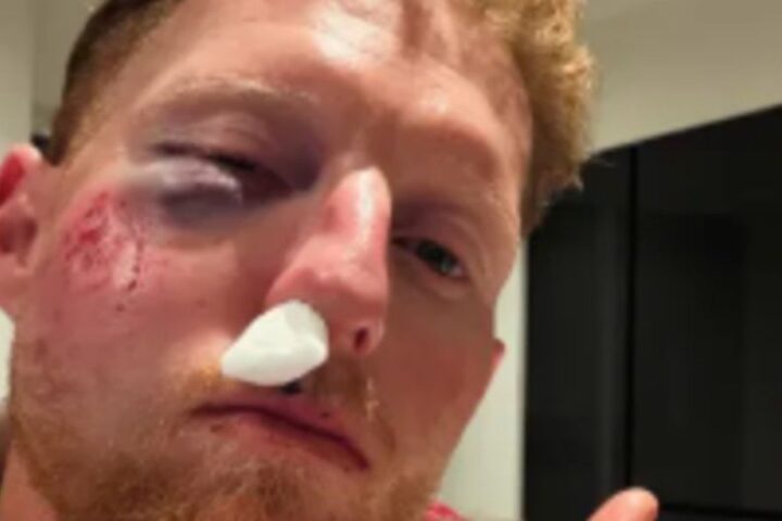 Ben Stokes injured in coaching session, reassures young player with thoughtful call