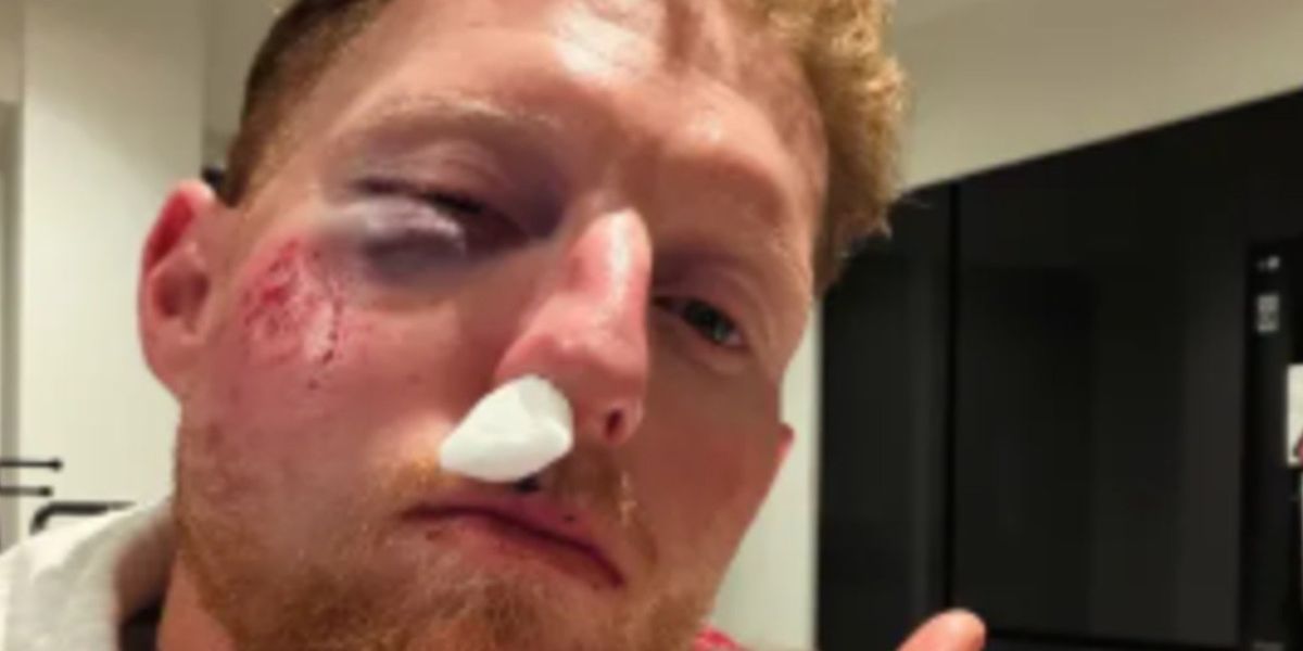Ben Stokes injured in coaching session, reassures young player with thoughtful call