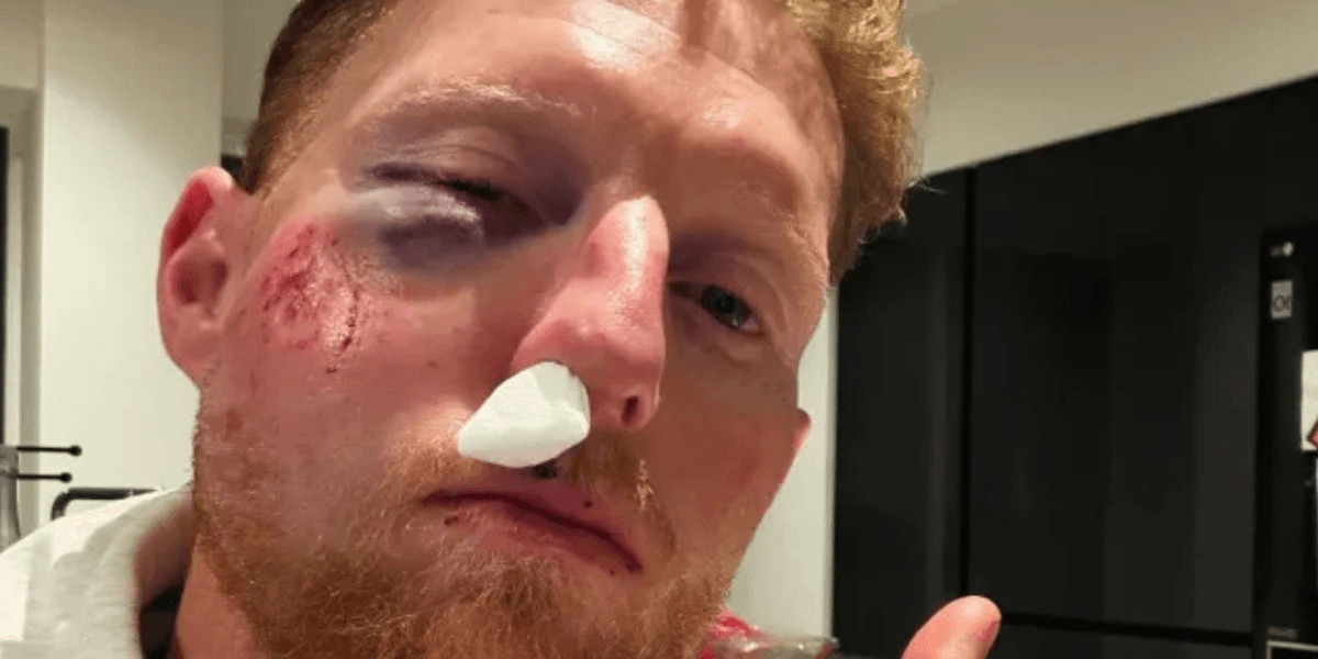 Ben Stokes suffers facial injuries after being struck by cricket ball in training session