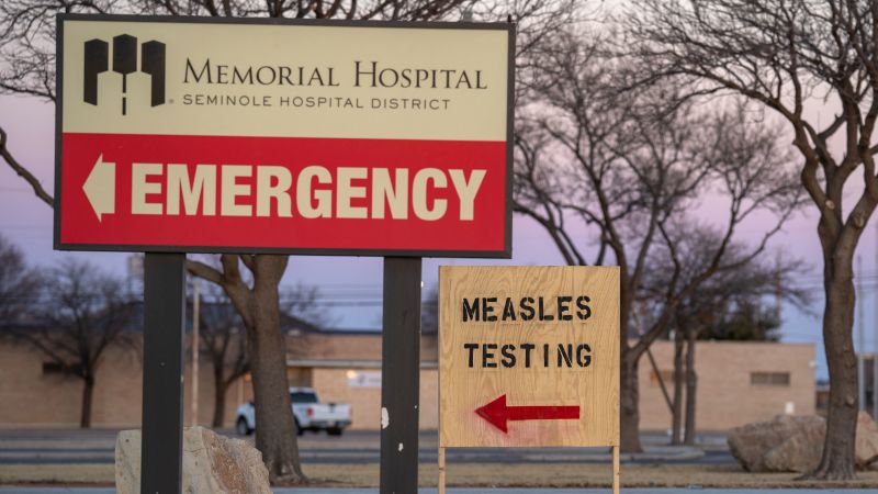 Hospitals face rising measles cases as many doctors lack experience with the virus