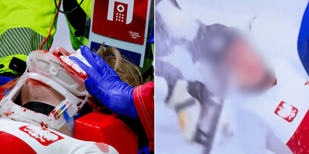 Kamila Sellier suffers serious facial injury in speed skating accident at Winter Olympics
