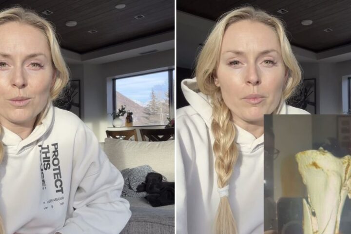 Lindsey Vonn reveals life-saving surgery after serious leg injury at the Winter Olympics