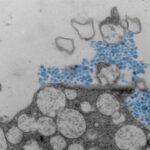 Scientists investigate why rhinovirus affects people differently in severity and symptoms