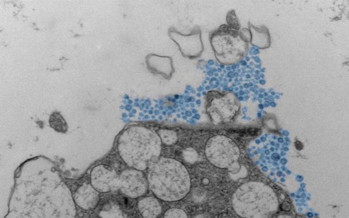 Scientists investigate why rhinovirus affects people differently in severity and symptoms