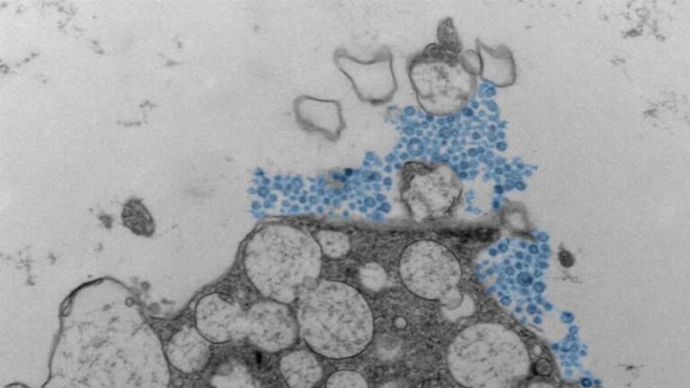 Scientists investigate why rhinovirus affects people differently in ...
