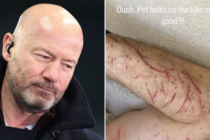 Alan Shearer shares injury update after bike accident caused by pothole