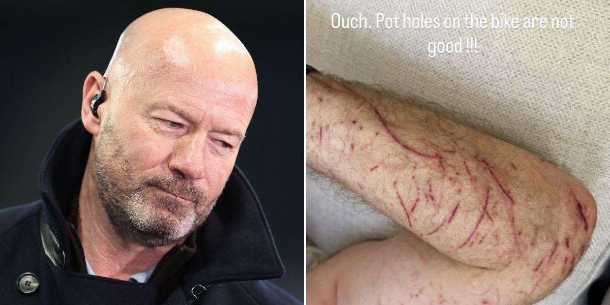 Alan Shearer shares injury update after bike accident caused by pothole
