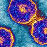 Mumps cases rise as health officials warn of increase in vaccine-preventable diseases