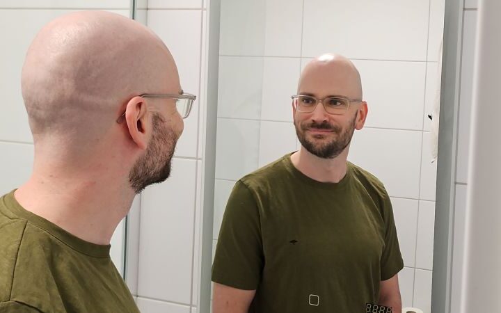 Shaving heads: a decision transforming self-image and confidence
