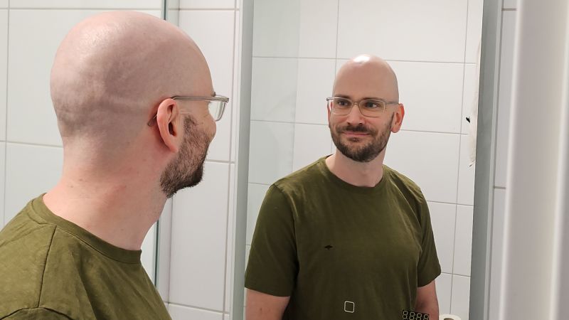 Shaving heads: a decision transforming self-image and confidence