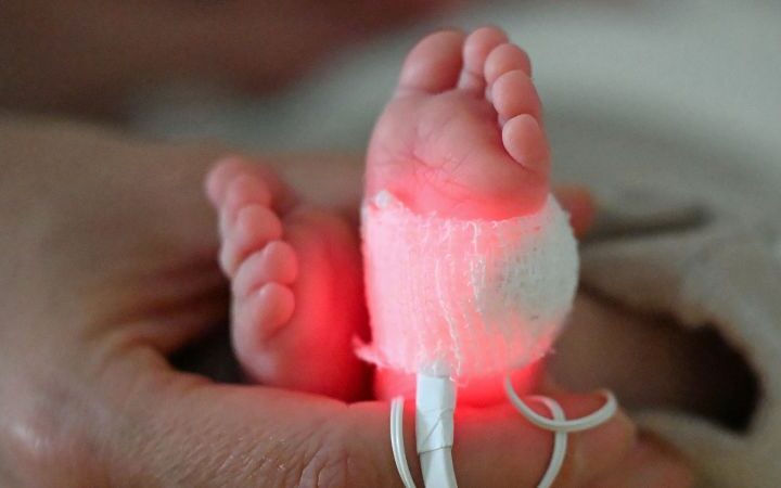 Study links plastic chemicals to millions of preterm births and infant deaths globally