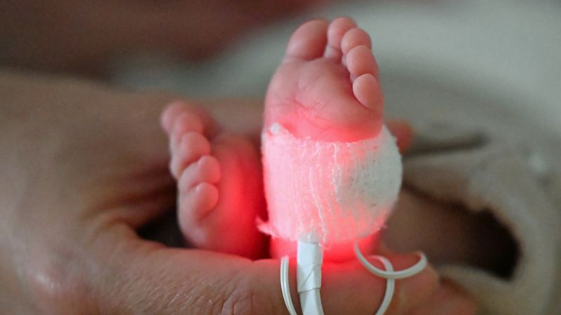 Study links plastic chemicals to millions of preterm births and infant deaths globally