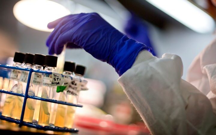 CDC suspends diagnostic testing for multiple infectious diseases amid staffing reductions