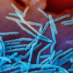 RSV continues to spread, prompting states to extend immunization period for young children