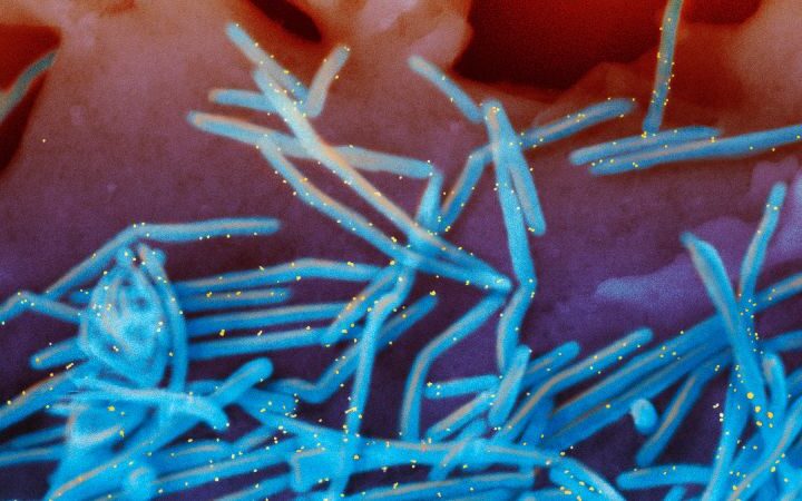 RSV continues to spread, prompting states to extend immunization period for young children