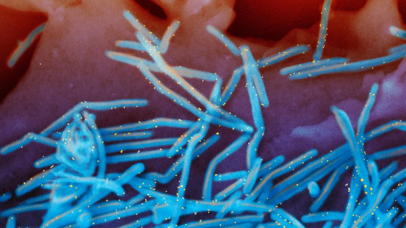 RSV continues to spread, prompting states to extend immunization period for young children