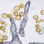Cruise ship outbreak linked to hantavirus claims three lives; investigation ongoing
