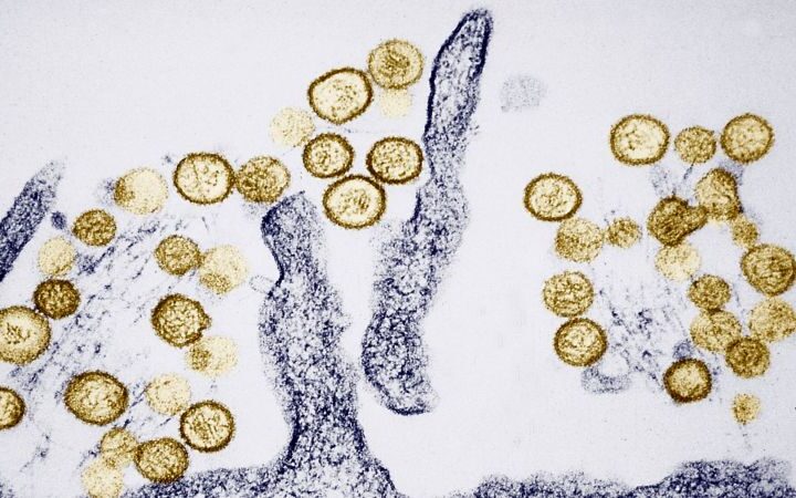 Cruise ship outbreak linked to hantavirus claims three lives; investigation ongoing