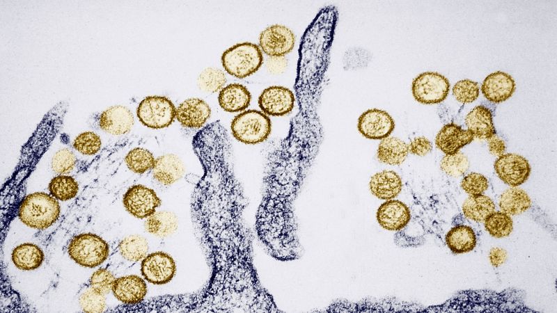 Cruise ship outbreak linked to hantavirus claims three lives; investigation ongoing