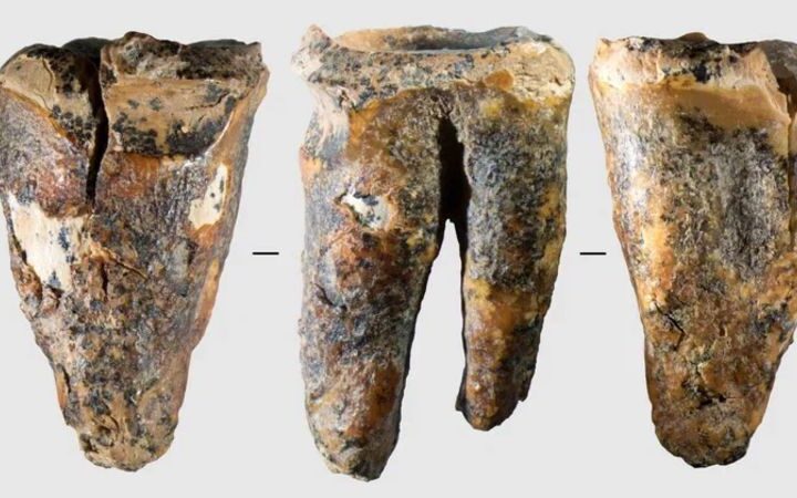 Neanderthal tooth provides oldest evidence of dental intervention in prehistoric humans