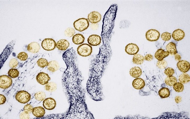 Passengers evacuated from cruise ship amid hantavirus outbreak with rising case counts