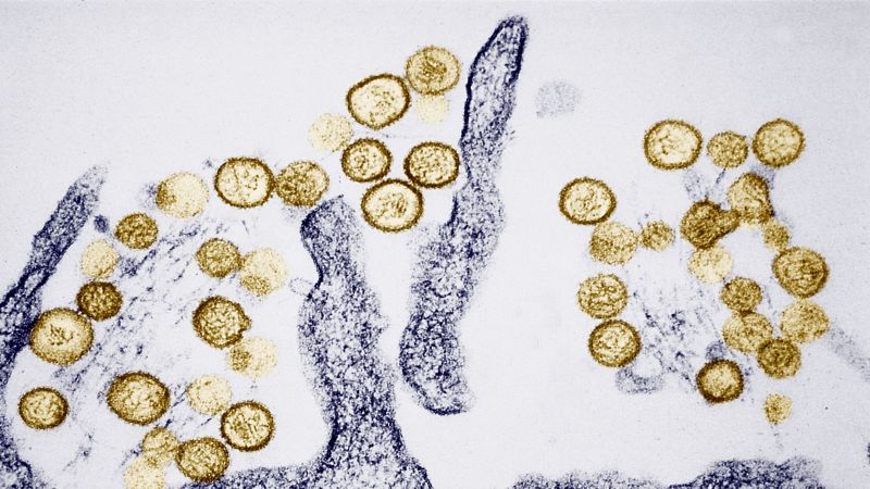 Passengers evacuated from cruise ship amid hantavirus outbreak with rising case counts
