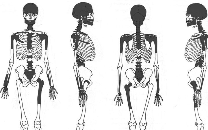 Study reveals Iron Age Scottish woman may have undergone brain removal during burial rites