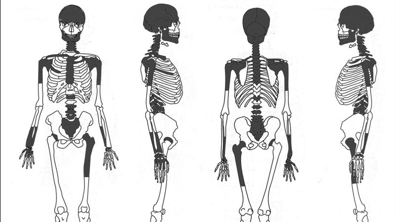 Study reveals Iron Age Scottish woman may have undergone brain removal during burial rites