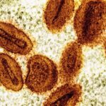 Two scientists charged with smuggling deactivated mpox virus into the US