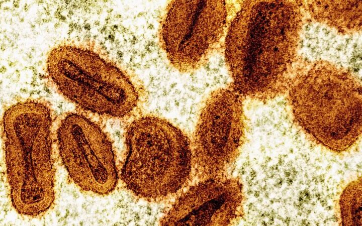 Two scientists charged with smuggling deactivated mpox virus into the US
