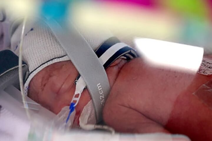 Identical quadruplet girls born in Australia, believed to be a rare occurrence
