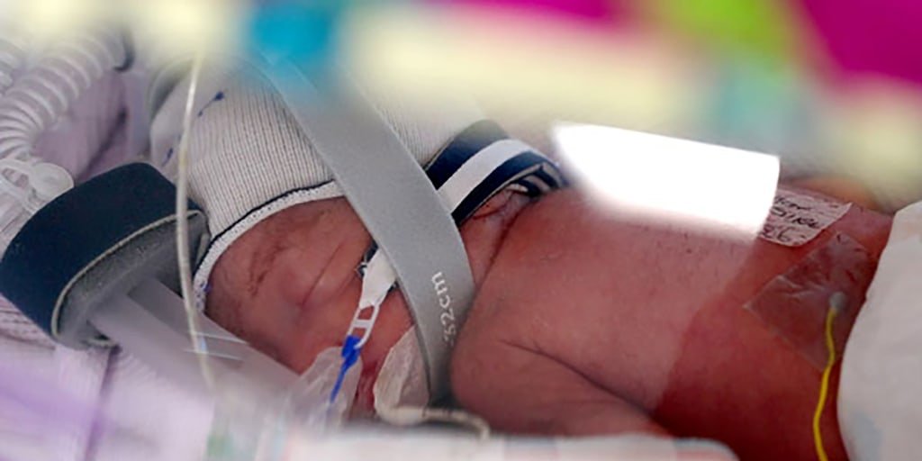 Identical quadruplet girls born in Australia, believed to be a rare occurrence