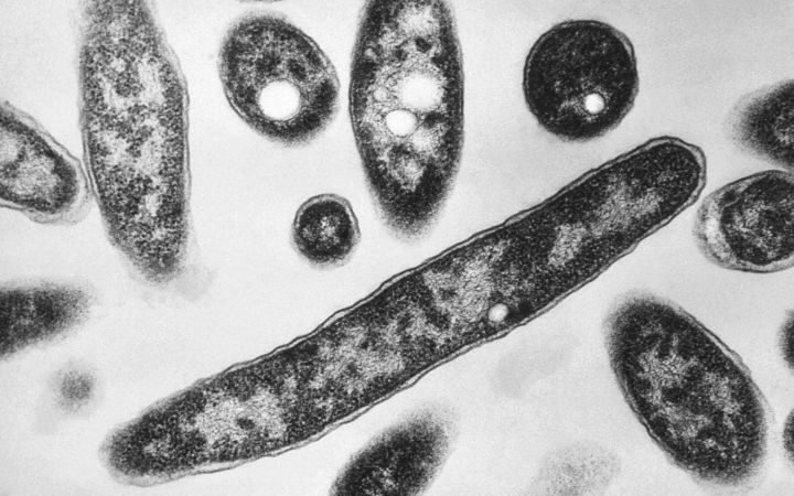 Legionnaires’ disease outbreak in New York City linked to contaminated cooling towers